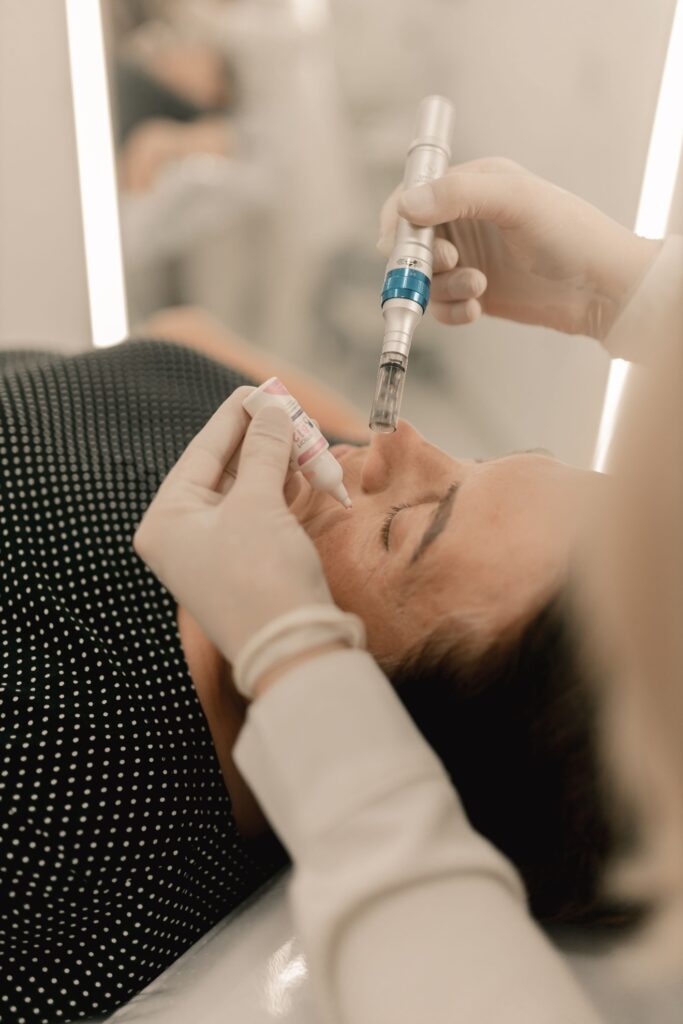 Microneedling treatment session in progress at Sarvi Studio Calgary