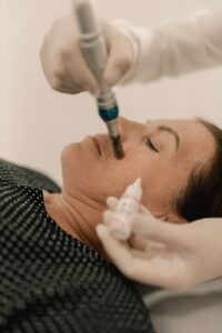 Tracking skin texture progress across a microneedling series